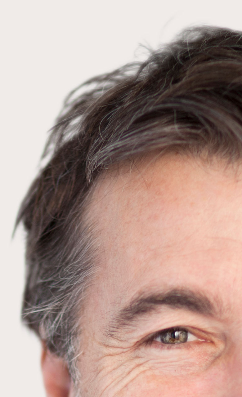 Zoom sur les rides d'un homme afin d'illustrer la chirurgie esthétique pour les hommes proposés chez Concept Clinic, clinique de chirurgie esthétique à Genève par le Docteur Schlaudraff